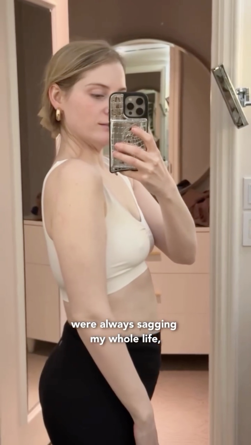 Meghan Trainor shares about her breast lift journey, March 2025